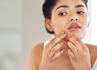 Мілія: Причини, Профілактика та Методи Лікування, Рекомендовані Дерматологами